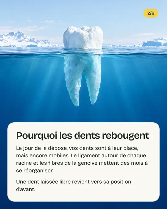 Deuxième image&nbsp;: une dent dessinée comme un iceberg, «&nbsp;Pourquoi les dents rebougent&nbsp;»