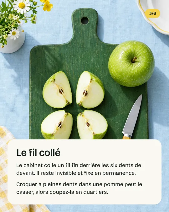 Troisième image&nbsp;: une pomme coupée en quartiers, «&nbsp;Le fil collé&nbsp;»