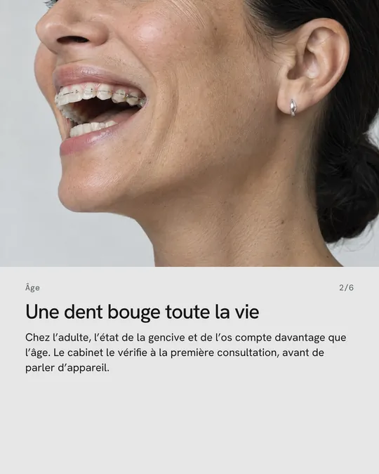 Deuxième image&nbsp;: une femme rit, «&nbsp;Une dent bouge toute la vie&nbsp;»