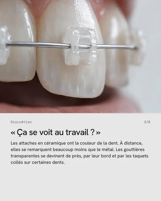 Troisième image&nbsp;: des attaches céramique en gros plan, «&nbsp;Ça se voit au travail&nbsp;?&nbsp;»
