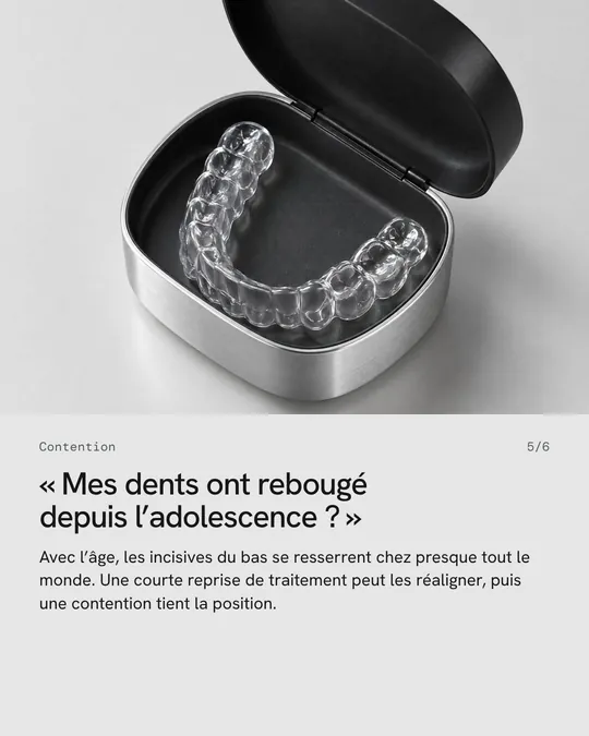 Cinquième image&nbsp;: une gouttière dans sa boîte, «&nbsp;Mes dents ont rebougé depuis l’adolescence&nbsp;?&nbsp;»