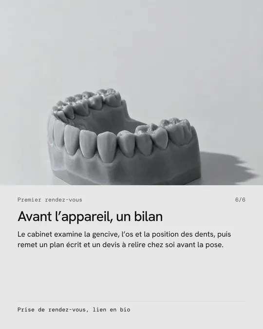 Sixième image&nbsp;: un moulage de dents, «&nbsp;Avant l’appareil, un bilan&nbsp;»